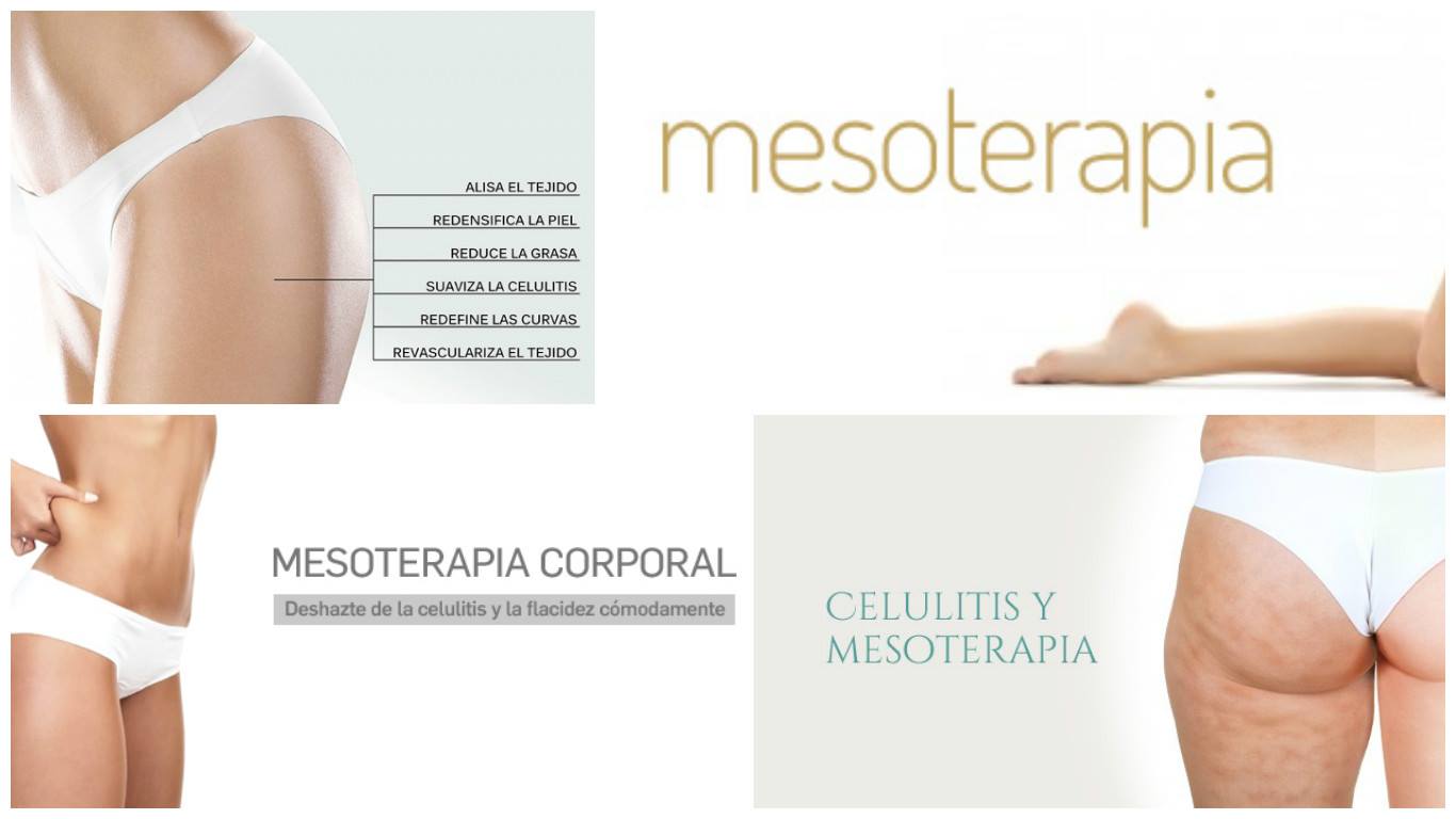 (c) Mesoterapiaypresoterapia.com