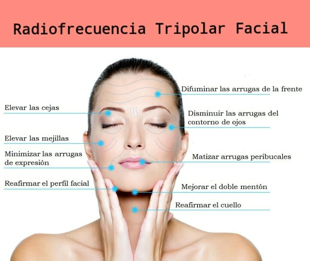 2 Tratamientos con radiofrecuencia tripolar y ultracavitación