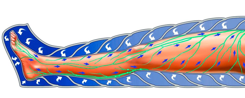 Presoterapia piernasg